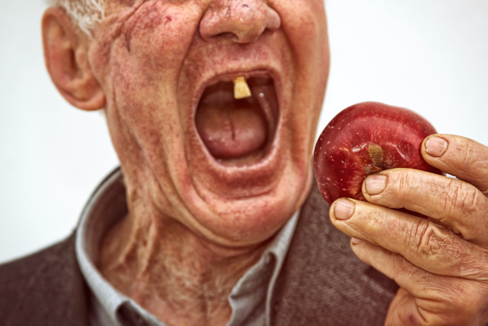 Mann mit nur einem Zahn und Apfel
